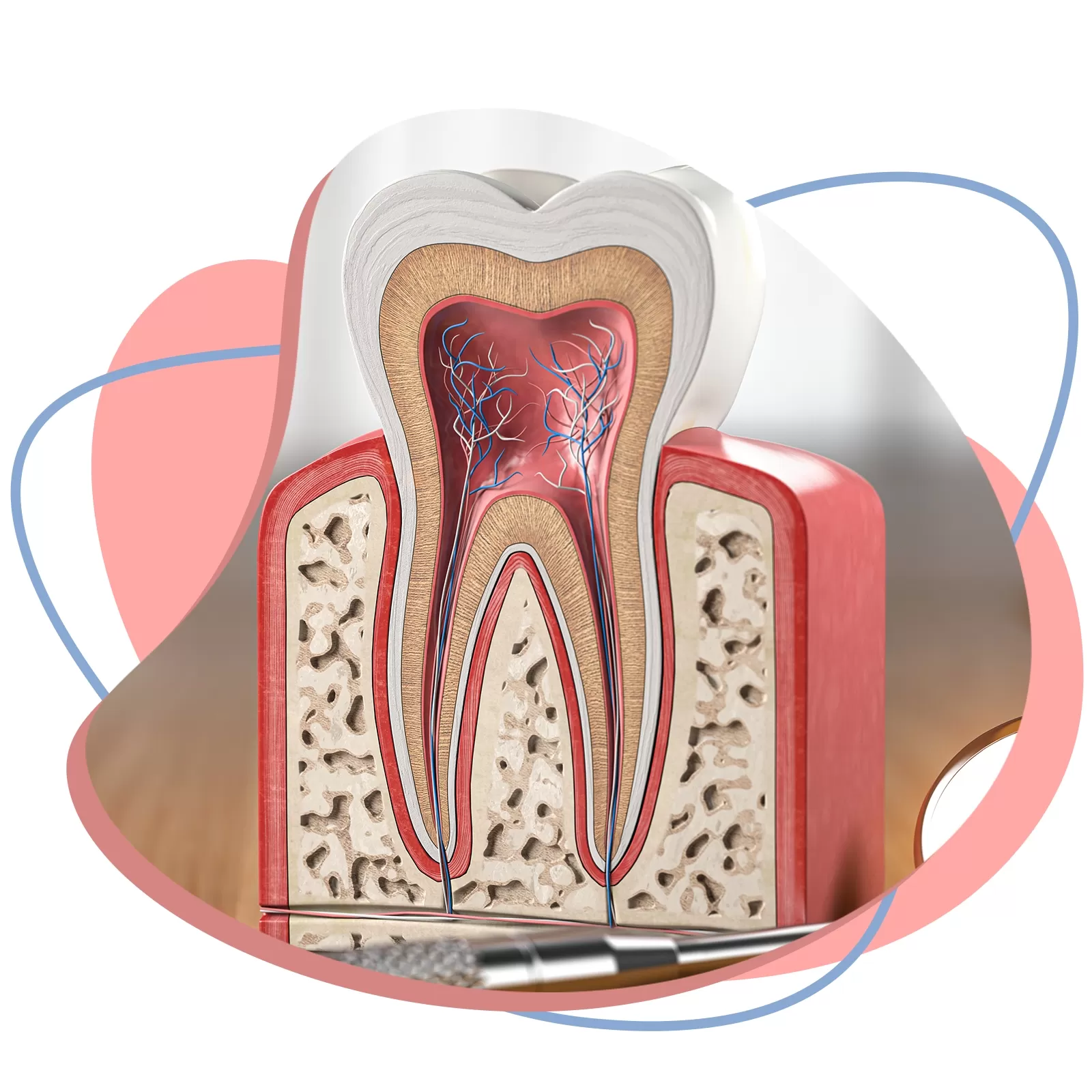 Endodontia em Cruz Alta